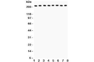 Western blot testing of Integrin alpha 5 antibody and Lane 1:  rat brain;  2: mouse brain;  3: human MM231;  4: (h) HeLa;  5: (h) Jurkat;  6: (h) 293T;  7: (m) Neuro-2a;  8: (r) PC12 lysate;  Expected size: 115-160KD;  Observed size: 220KD