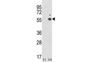 Western Blotting (WB) image for anti-Intercellular Adhesion Molecule 1 (ICAM1) (AA 488-514) antibody (ABIN3028746)