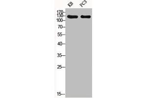 Western Blot analysis of KB PC-3 cells using Phospho-SHIP-1 (Y1021) Polyclonal Antibody (INPP5D antibody  (pTyr1021))