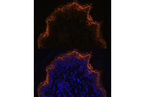 Immunofluorescence analysis of rat skin using SPRR1A antibody (ABIN7270369) at dilution of 1:100. (SPRR1A antibody)