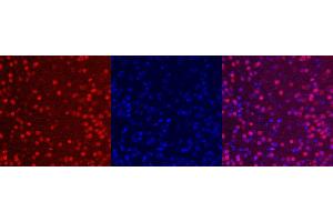 Immunohistochemistry (IHC) image for anti-ISL LIM Homeobox 1 (ISL1) antibody (ABIN7456087) (ISL1 antibody)