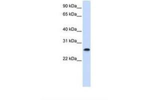 Image no. 1 for anti-PHD Finger Protein 19 (PHF19) (C-Term) antibody (ABIN6739281) (PHF19 antibody  (C-Term))