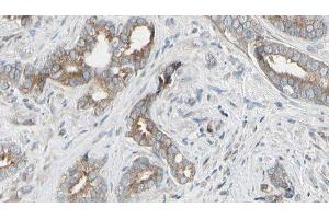 ABIN6276516 at 1/100 staining Human prostate tissue by IHC-P. (ARHGEF7 antibody  (Internal Region))