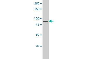 CLCN7 polyclonal antibody (A01), Lot # 060703JCS1 Western Blot analysis of CLCN7 expression in HL-60 . (CLCN7 antibody  (AA 706-805))