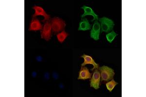 ABIN6261853 and ABIN6278465 staining Hela cells by IF/ICC.