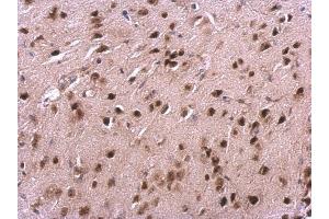 IHC-P Image VHL antibody detects VHL protein at cytosol and nucleus on mouse fore brain by immunohistochemical analysis. (VHL antibody)