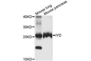 Western blot analysis of extracts of various cell lines, using IYD antibody (ABIN5996813) at 1/1000 dilution. (IYD antibody)