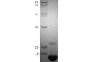 Validation with Western Blot (CCL8 Protein)