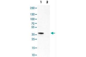 Western Blot analysis of Lane 1: RH-30 and Lane 2: CACO-2 cell lysates with SIX1 monoclonal antibody, clone CL0185 .