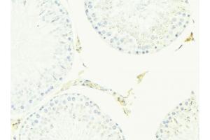 ABIN6276968 at 1/100 staining Mouse testis tissue by IHC-P. (ACPP antibody  (Internal Region))