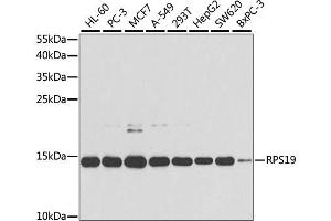 Western blot analysis of extracts of various cell lines, using RPS19 antibody (ABIN1874653) at 1:1000 dilution. (RPS19 antibody)