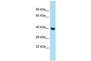 Host:  Rabbit  Target Name:  Pdcd2  Sample Type:  Rat Kidney lysates  Antibody Dilution:  1. (PDCD2 antibody  (Middle Region))