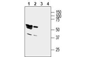 Western blot analysis of rat brain lysate (lanes 1 and 3) and mouse brain membranes (lanes 2 and 4): - 1,2. (GIPC1 antibody  (Intracellular, N-Term))