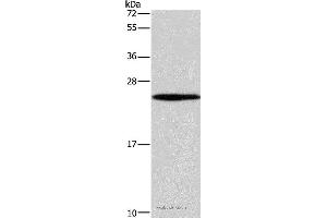 Western blot analysis of 231 cell, using GUK1 Polyclonal Antibody at dilution of 1:400 (GUK1 antibody)