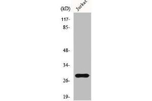 Western Blot analysis of Jurkat cells using GSTT1/4 Polyclonal Antibody (GSTT1 antibody  (N-Term))