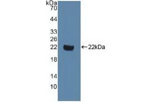 Western blot analysis of recombinant Human DVL1. (DVL1 antibody  (AA 150-285))