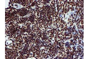 Image no. 2 for anti-Peptidyl Arginine Deiminase, Type IV (PADI4) antibody (ABIN1500017) (PAD4 antibody)