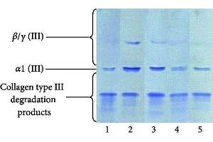 Western Blotting (WB) image for anti-Collagen, Type III, alpha 1 (COL3A1) antibody (ABIN5596830)