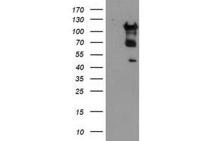 HEK293T cells were transfected with the pCMV6-ENTRY control (Left lane) or pCMV6-ENTRY MTFMT (Right lane) cDNA for 48 hrs and lysed. (MTFMT antibody  (AA 175-389))
