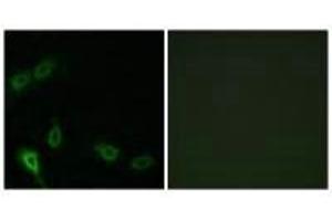 Immunofluorescence analysis of A549 cells, using MARK2 antibody. (MARK2 antibody  (N-Term))
