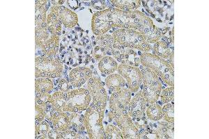 Immunohistochemistry of paraffin-embedded rat kidney using AP2A1 Antibody. (alpha Adaptin antibody  (AA 1-260))