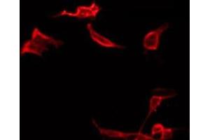 ABIN6266572 staining LOVO by IF/ICC. (Cytokeratin 19 antibody  (Internal Region))