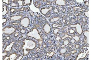 IHC analysis of GLDC using anti-GLDC antibody (ABIN7602072).