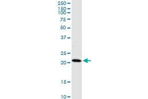 HDDC3 monoclonal antibody (M05), clone 7E6. (HDDC3 antibody  (AA 1-140))