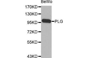 Western blot analysis of extracts of BeWo cell line, using PLG antibody. (PLG antibody  (AA 20-300))