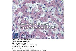 Immunohistochemistry (IHC) image for anti-Solute Carrier Family 27 (Fatty Acid Transporter), Member 2 (SLC27A2) (N-Term) antibody (ABIN2781594) (SLC27A2 antibody  (N-Term))