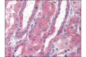 Immunohistochemistry (Paraffin-embedded Sections) (IHC (p)) image for anti-Chemokine (C-X-C Motif) Receptor 4 (CXCR4) (AA 14-40), (Extracellular Domain), (N-Term) antibody (ABIN614959)