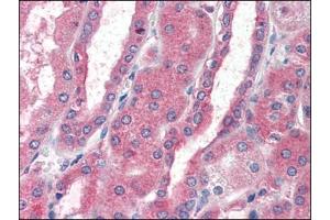 Human Kidney (formalin-fixed, paraffin-embedded) stained with CXCR4at 5 µg/ml followed by biotinylated anti-goat IgG secondary antibody, alkaline phosphatase-streptavidin and chromogen. (CXCR4 antibody  (Extracellular Domain, N-Term))