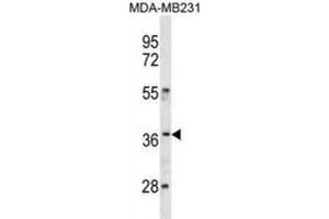 Western Blotting (WB) image for anti-Homeobox C10 (HOXC10) antibody (ABIN3001305) (HOXC10 antibody)