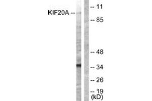 Western blot analysis of extracts from 293 cells, using KIF20A (Ab-528) Antibody. (KIF20A antibody  (AA 501-550))