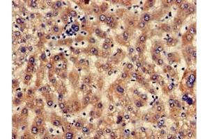 Immunohistochemistry of paraffin-embedded human liver tissue using ABIN7168659 at dilution of 1:100