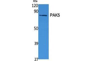 Western Blot (WB) analysis of specific cells using PAK5 Polyclonal Antibody. (PAK7 antibody  (C-Term))