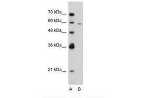 Image no. 3 for anti-Receptor-Interacting serine-threonine Kinase 3 (RIPK3) (AA 168-217) antibody (ABIN203367) (RIPK3 antibody  (AA 168-217))