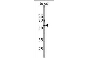 Western blot analysis of anti-PFKFB1 Antibody in Jurkat cell line lysates (35ug/lane). (PFKFB1 antibody  (N-Term))
