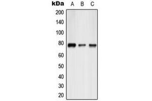 Western blot analysis of ATF6B expression in HepG2 (A), mouse liver (B), rat liver (C) whole cell lysates. (ATF6B antibody  (Center))