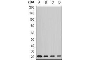 Western blot analysis of AGR2 expression in HT29 (A), MCF7 (B), mouse liver (C), rat lung (D) whole cell lysates. (AGR2 antibody)