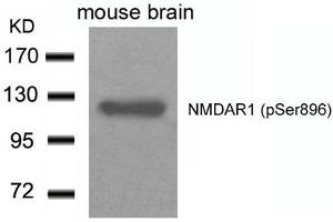 Western blot analysis of extracts from Mouse Brain tissue using NMDAR1(Phospho-Ser896) Antibody. (GRIN1/NMDAR1 antibody  (pSer896))