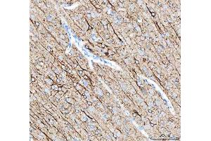 IHC analysis of Alpha Internexin using anti-Alpha Internexin antibody (ABIN4886634). (INA antibody  (AA 71-161))