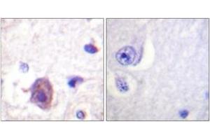 Immunohistochemistry analysis of paraffin-embedded human brain, using FAK (Phospho-Ser910) Antibody. (FAK antibody  (pSer910))