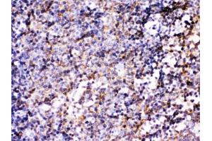 IHC testing of FFPE mouse lymph node with BCAR3 antibody. (BCAR3 antibody)