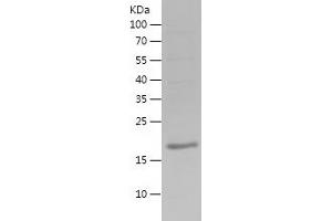 Western Blotting (WB) image for Estrogen Receptor 1 (ESR1) (AA 2-170) protein (His tag) (ABIN7282353) (Estrogen Receptor alpha Protein (AA 2-170) (His tag))