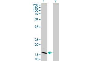 Lane 1: IFNB1 transfected lysate ( 22.