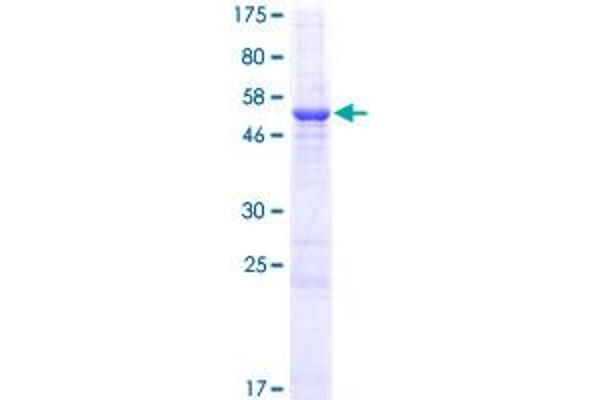 RCAN2 Protein (AA 1-225) (GST tag)