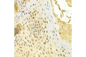 Immunohistochemistry of paraffin-embedded human esophageal using MAD2L1 antibody at dilution of 1:100 (x400 lens).
