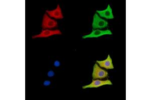 ABIN7096618 and ABIN7100682 staining HepG2 cells by IF/ICC. (DIS3L antibody)