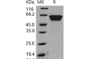 Western Blotting (WB) image for Fetuin B (FETUB) protein (His tag) (ABIN7320228) (FETUB Protein (His tag))